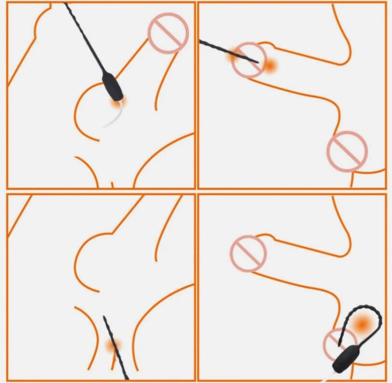 Back Vibrating Urethral Catheter For Men